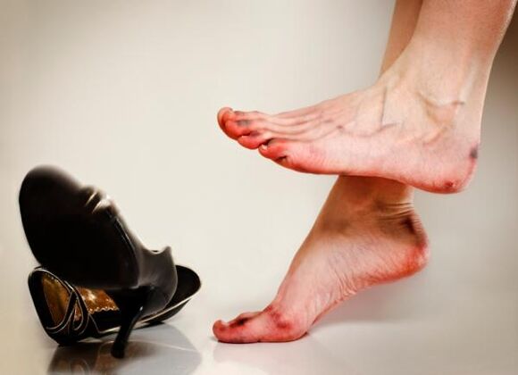 Die Entstehung von Zehennagelpilz kann durch enge Schuhe verursacht werden